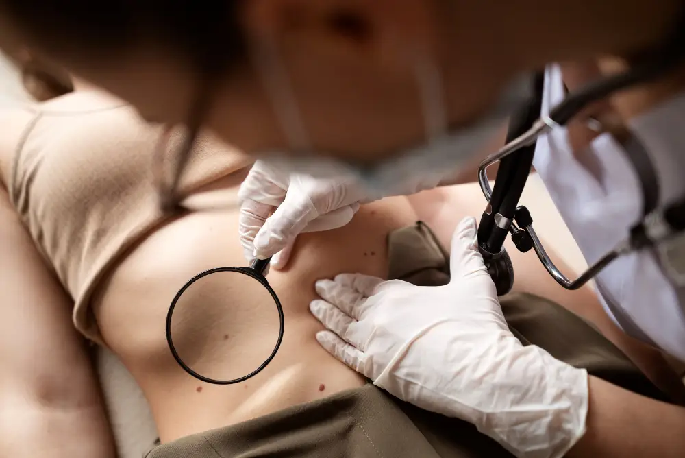 Comprehensive Skin Cancer Screening Services in Katy, TX