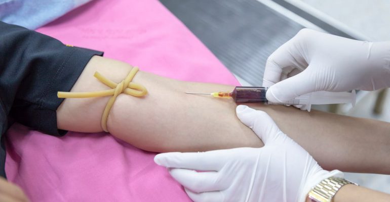 Does Urgent Care Do Blood Work